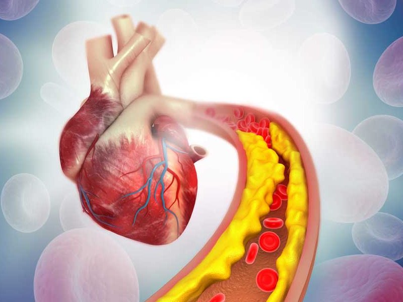Cholesterol-Management